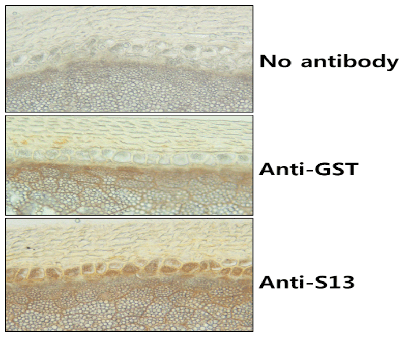 No antibody, Anti-GST, Anti-S13